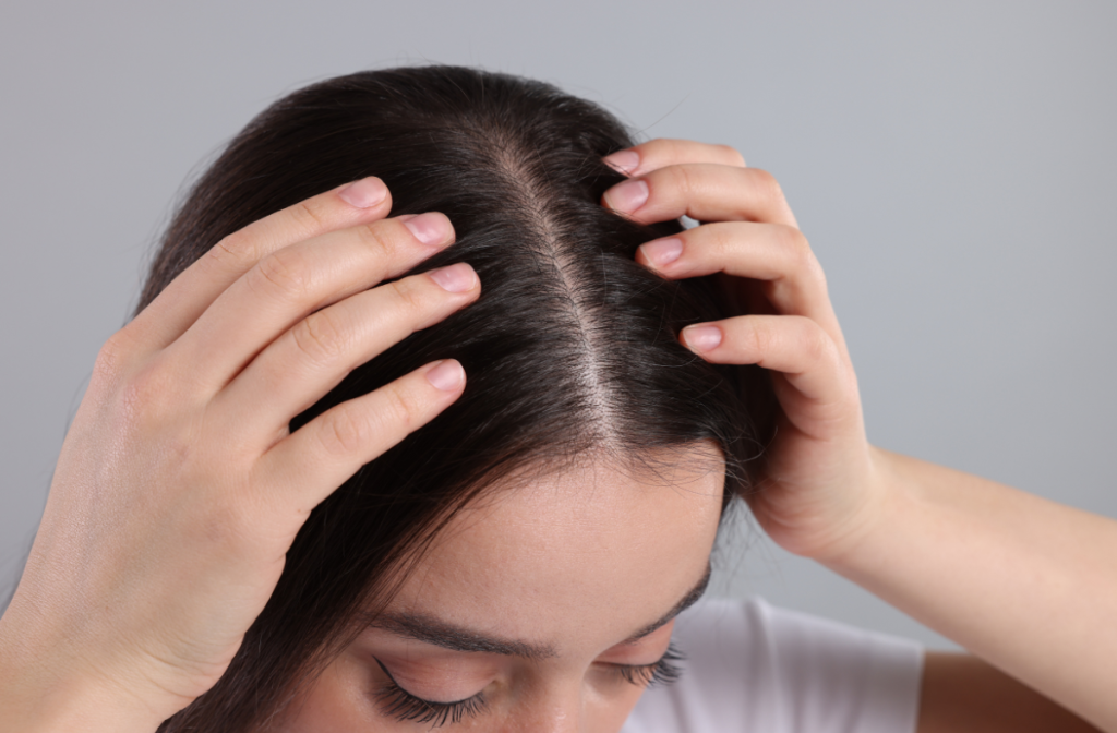 Woman with brown hair showing scalp